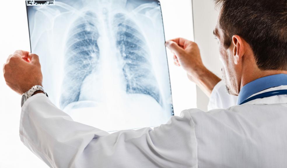 Doctors in Devon urge people to be alert to symptoms of lung cancer